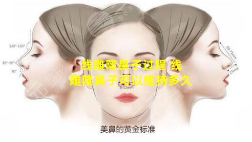 线雕隆鼻子过程 线雕隆鼻子可以维持多久